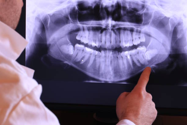 Best Emergency Dentist for Lost Fillings or Crowns in Loganville, PA